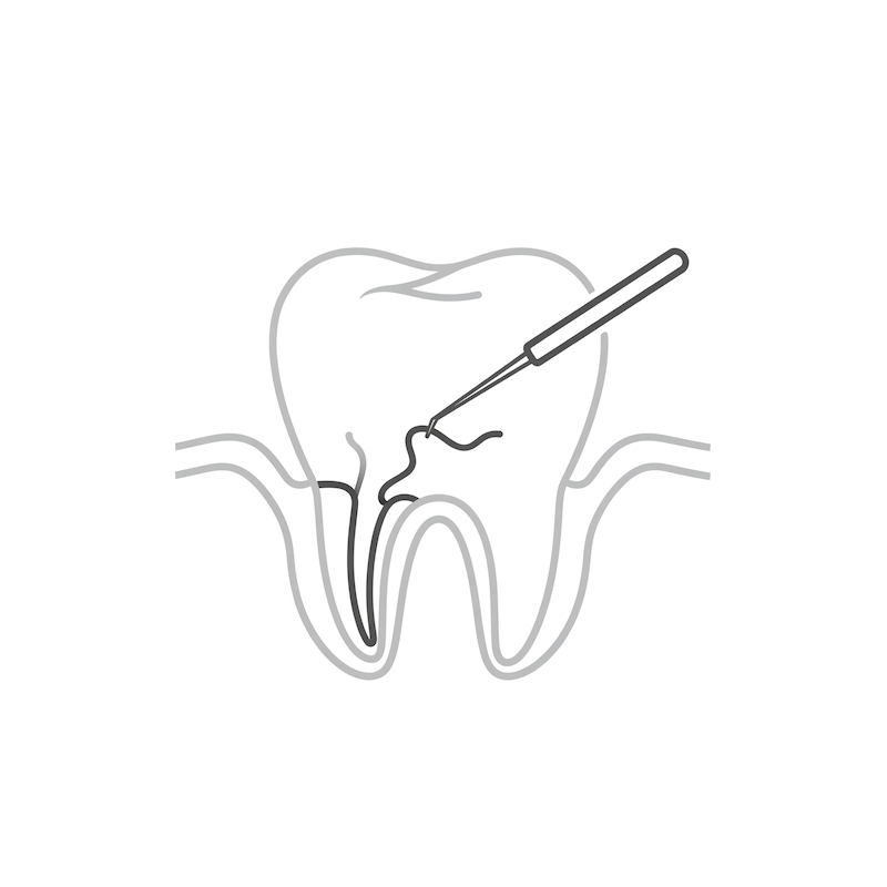 Icono eliminación de la pulpa dañada